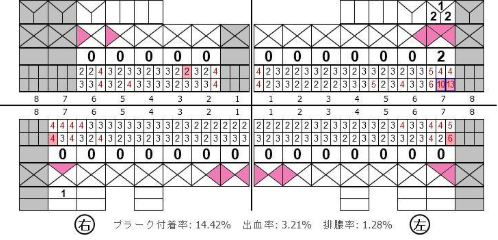 メインテナンス期（2025.7）